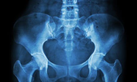 Hospitals Fast-Track Treatments for Hip Fractures