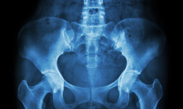 Preparing for Joint Commission Advanced Certification for Total Hip and Total Knee Replacement:  Q&A