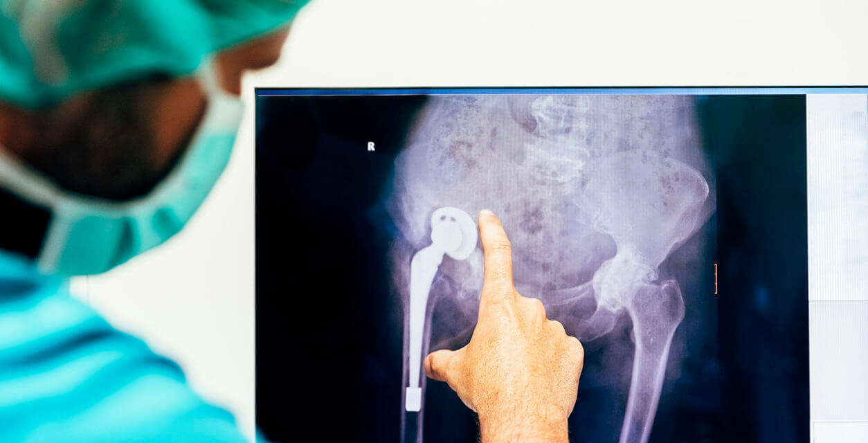 Hospitals leery of CMS proposal to pay for joint replacements in ASCs